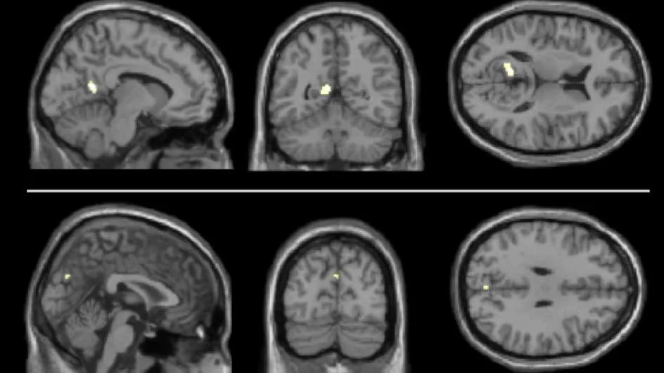 brain-sahakian
