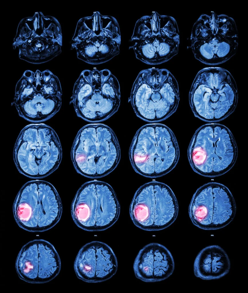 brain-sahakian